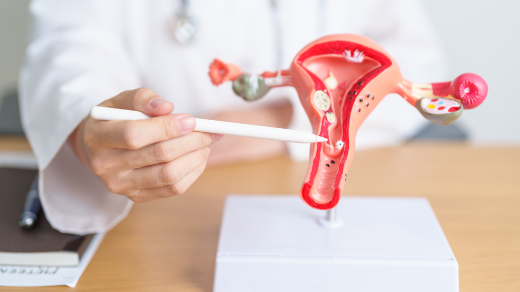 Working Women Are at Higher Risk for Uterine Fibroids: Here's How to Prevent Them